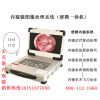 史克斯內(nèi)窺鏡高清攝像系統(tǒng)/圖像處理系統(tǒng)/攝像機(jī)冷光源/監(jiān)視器